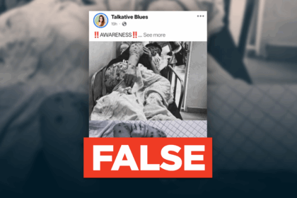 Viral photo of blistered person is NOT a monkeypox case in Iloilo City